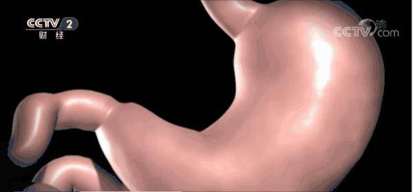 数量|为了瘦，女子跪求医生做手术