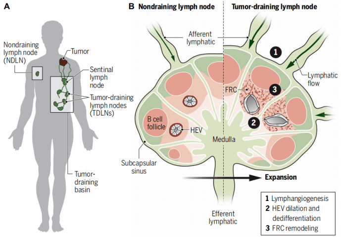 真菌影响肿瘤放疗效果sciimmunol深入解读肿瘤引流淋巴结
