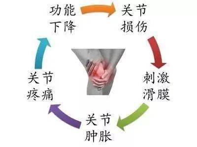 治疗滑膜炎的药物有哪些 032d36727aa64d639662e86b13815716.jpeg