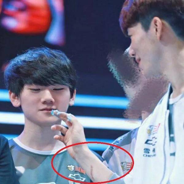 随着事情的发酵,theshy受伤的真正原因也被玩家曝光出来,因为当时的ig