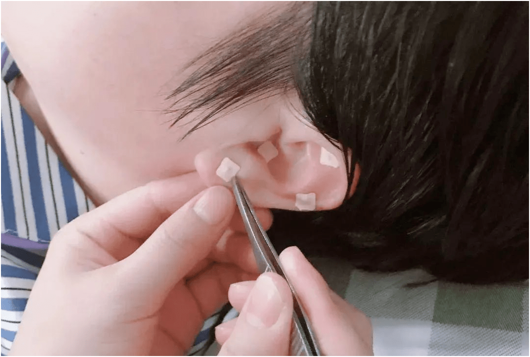 昆明耳鸣治疗