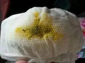 宝宝大便发绿咋回事?_胆绿素
