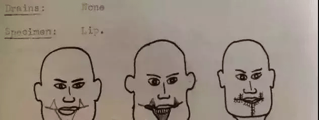 中国|观方好物 | 北京协和医院：我们从未出过维E乳