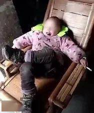 广告|吃了半年，左脸彻底溃烂：这款热门零食，正在危害6000万人的身体......