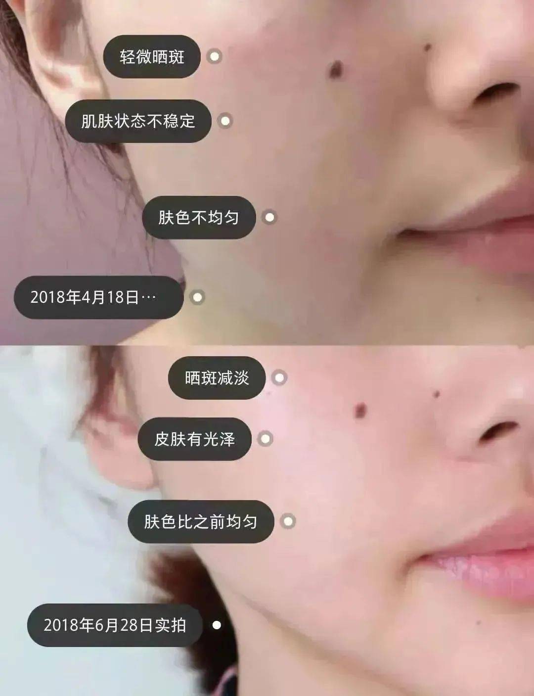 斑点|科颜氏淡斑精华买一送二，速来！