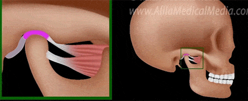 考试|小姑娘突然疼痛难忍、张不开口，医生说：这得治！