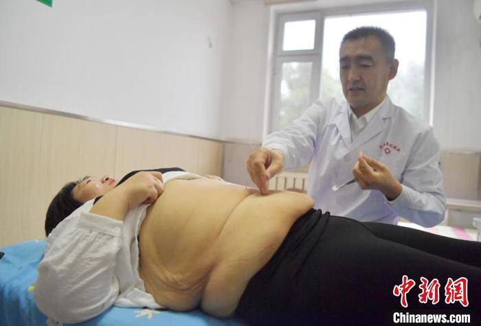 红灯|400斤超胖女孩9个月减180斤 立志成为减肥健身博主