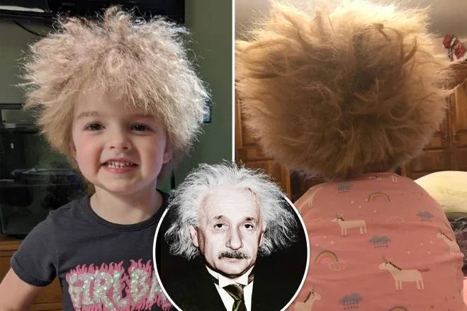 6岁女孩患有罕见疾病 与爱因斯坦有同款发型