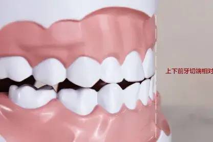 图片|5岁男孩突发急性肾炎，病根竟然是在口腔里