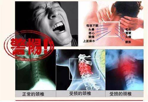 颈椎|头晕恶心手麻原来是颈椎出了毛病！睡它，30分钟缓解酸痛，1个月连血压都降了