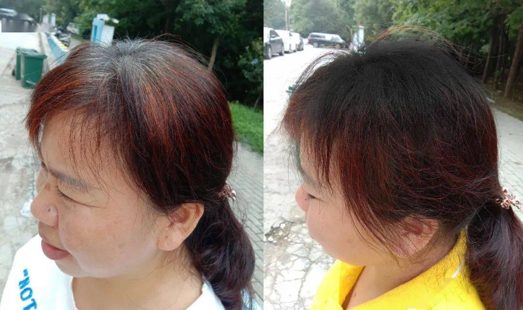 汪女士|白发越长越多？原来是这里出了毛病！坚持一招，养一头乌黑墨发！