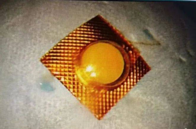 手术|服药时接了个电话，救命药成了“定时炸弹”