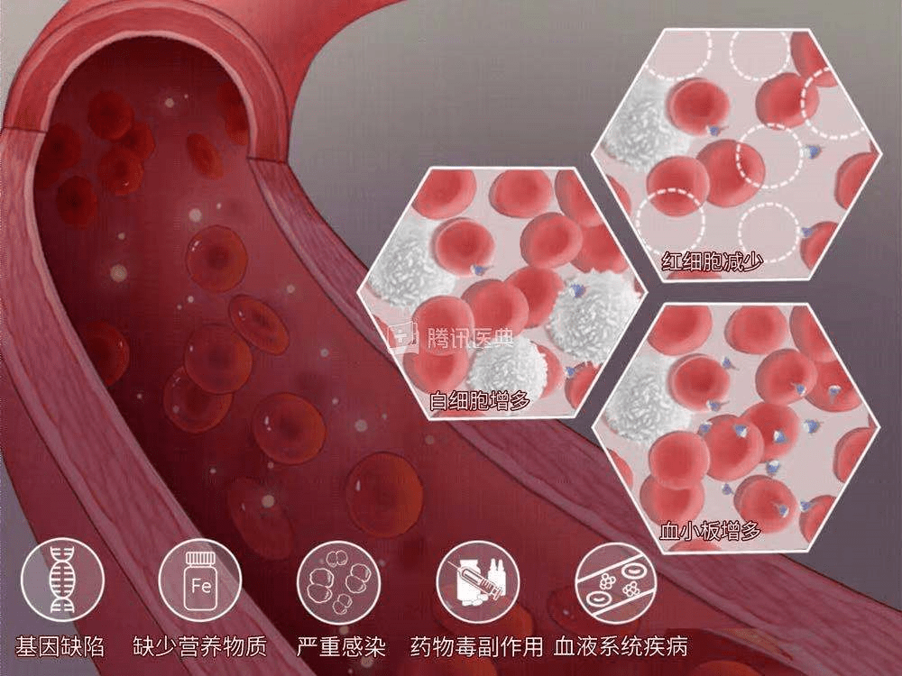 血液病患者如何预防感染