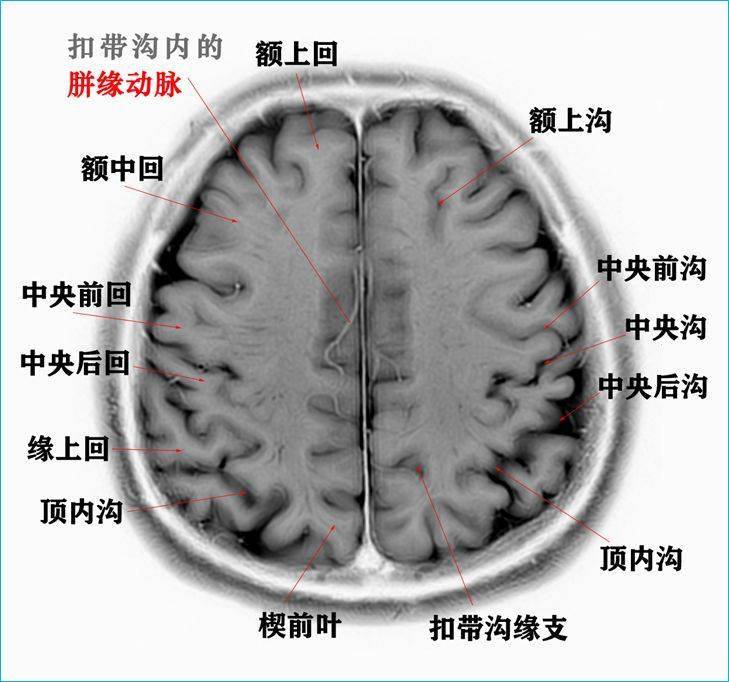 这个高清颅脑断层解剖图谱实在太棒了!【磁共振 大体标本】