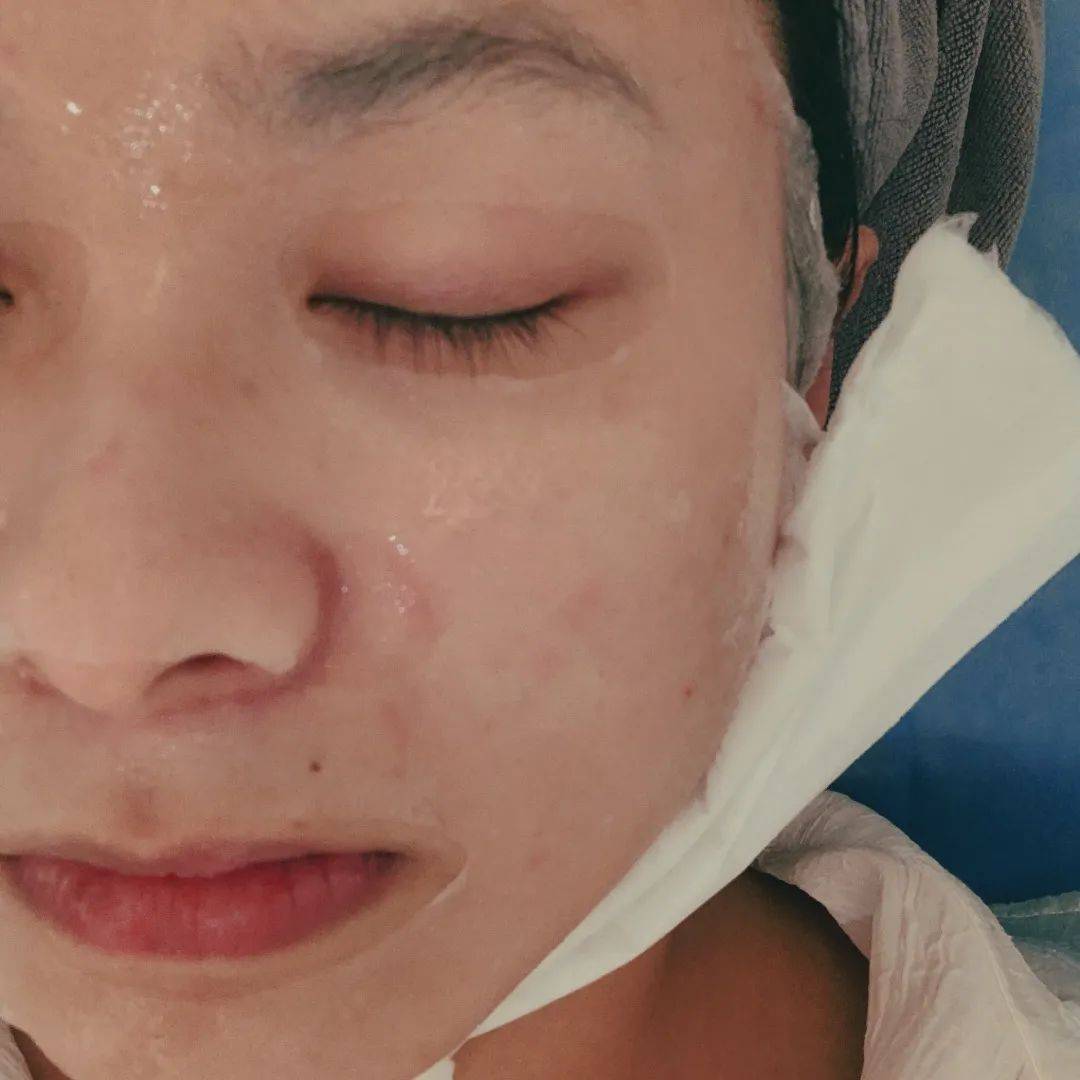 模式医美专场|| 超低价的光子嫩肤,又来啦!