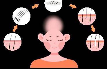 头发|脱发和正常掉发有本质区别！