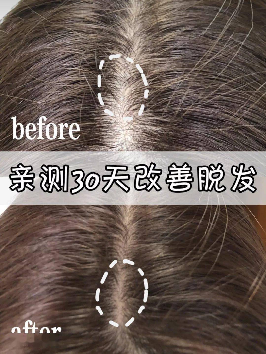 发型为了拯救发际线，日本人可是绞尽脑汁！