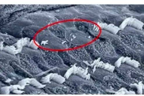 声音|手机音量超标会造成听力损伤，很多人都没注意