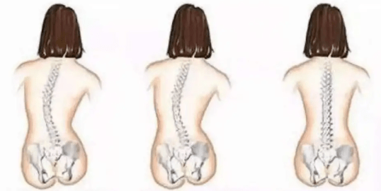 【健康黄金周】脊柱有话说:"你以为只是坐姿不好,其实是我生病了"