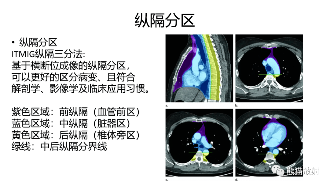 【省立影像讀片】前縱隔腫瘤 21.10