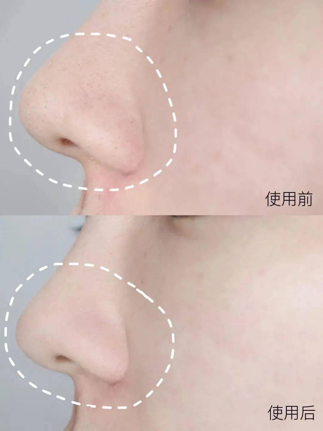 黑头获得世界品质评鉴大奖的洁颜泥，日本模特、艺人大爱，黑头、角质、粉刺用它都能搞定！