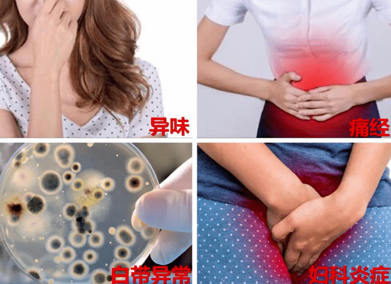 02妇科炎症包括盆腔炎,阴道炎,外阴炎,宫颈