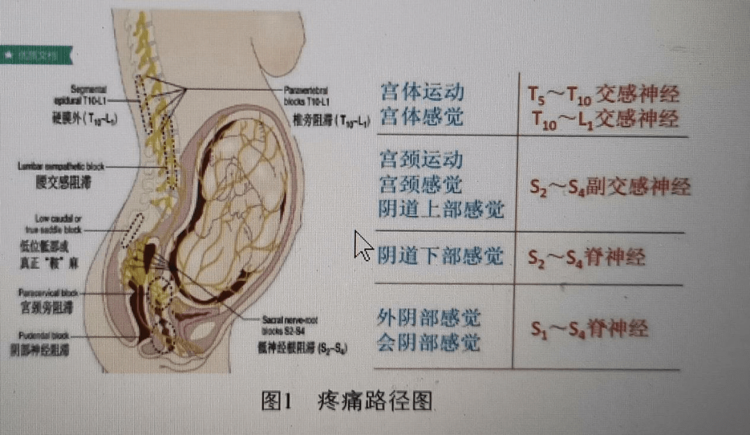 一,分娩疼痛产生的机制