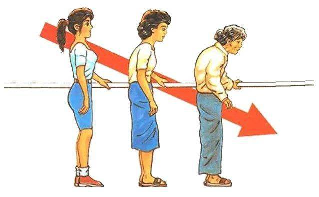 自由基与疾病 dcde91b3626f4da9818a188a035e9adc.jpeg