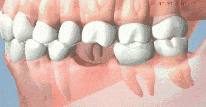 市民|@大连人！看牙消费福利券正在发放，符合条件的均可领取