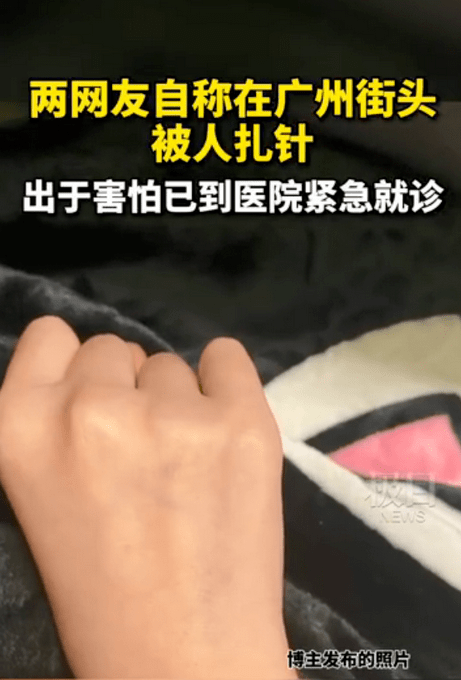 上街被針紮了會感染艾滋病嗎?疾控回答了!