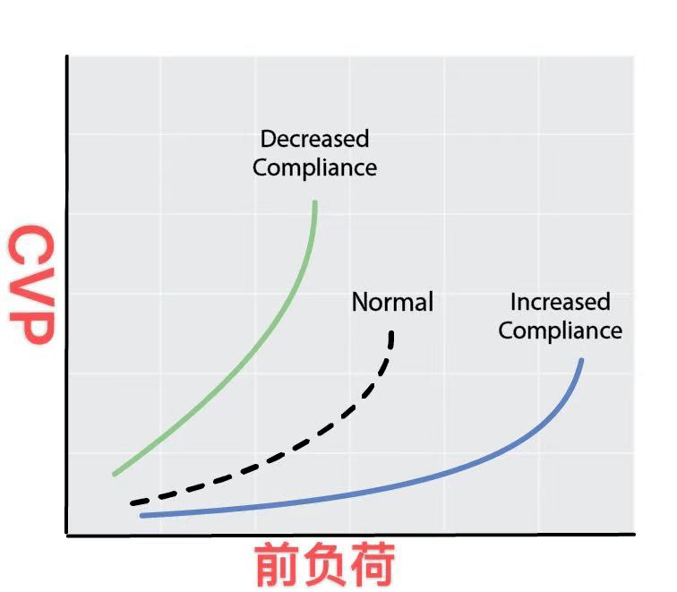 cvp還可以是負數?——那些關於cvp你不知道的事