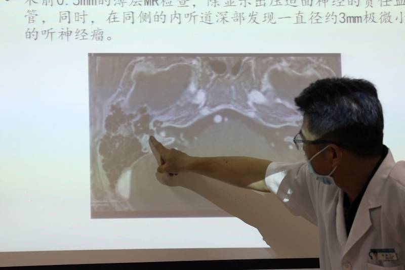 宋先生|小伙嘴角歪斜原是罹患四大神经系统疾病，精准评估后各个击破