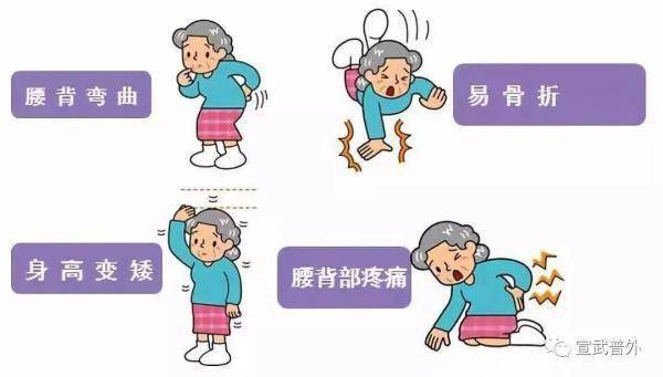 全身性|世界骨質疏松日——人人都要預防骨質疏松
