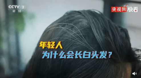 状态|熬夜会导致或加速长白发 你也有晚睡强迫症么？
