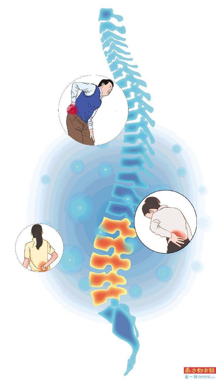 腰部|“门诊接待的最小患者仅8岁 脊柱疾病呈低龄化趋势”