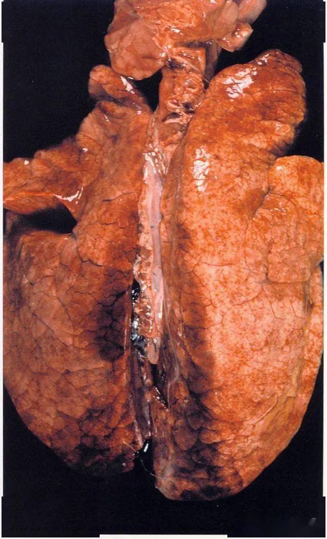 11 生长猪肺出血,肺表面有大量的斑点和淤血块