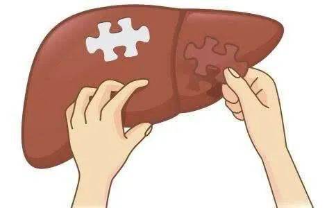 科普|【积医科普】怎样筛查肝癌