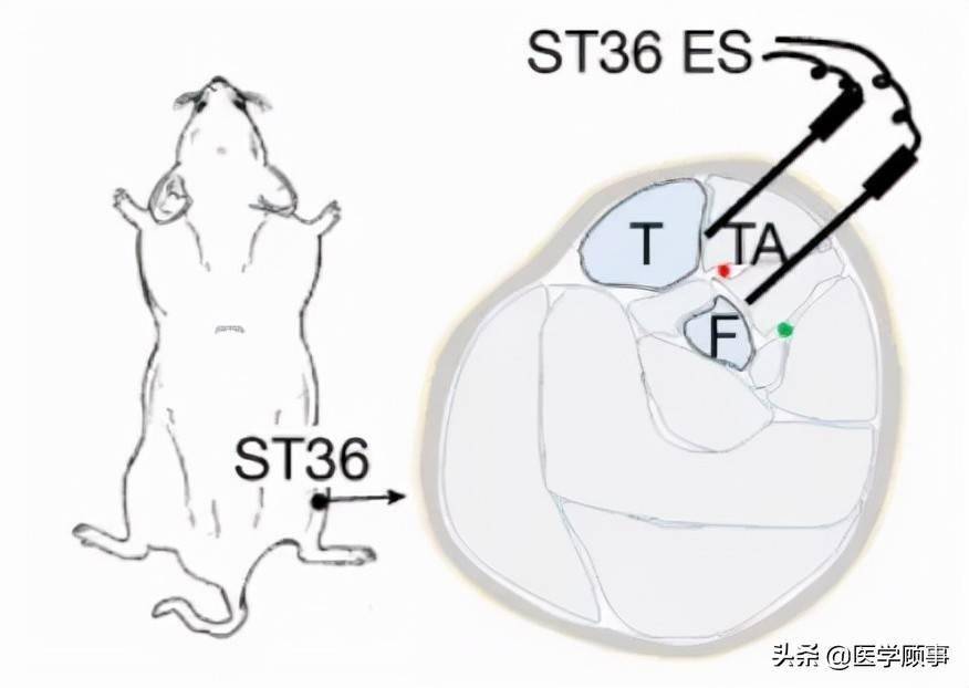 nature哈佛团队发现穴位存在证据针灸足三里穴可以抗炎