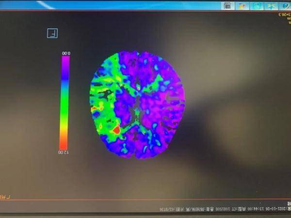 张迅恺|警惕！18岁小伙突然手脚无力，一查居然得了这种“老人病”！