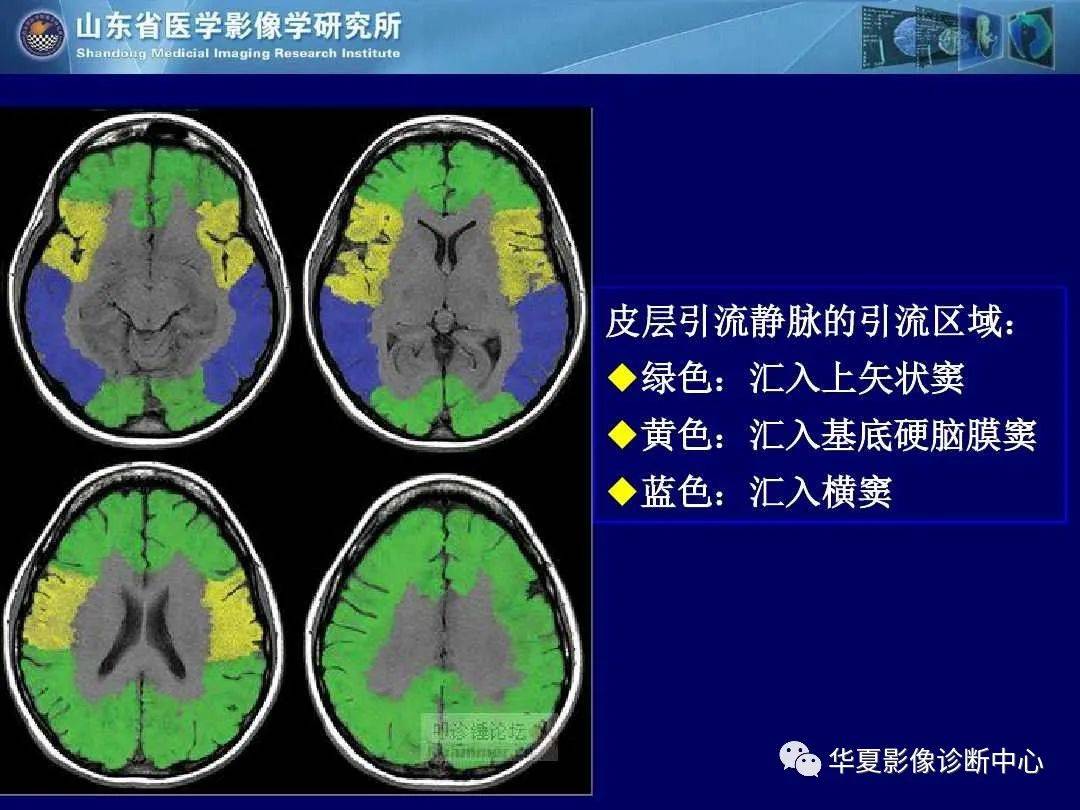 诊断|缺血性脑血管病的影像诊断