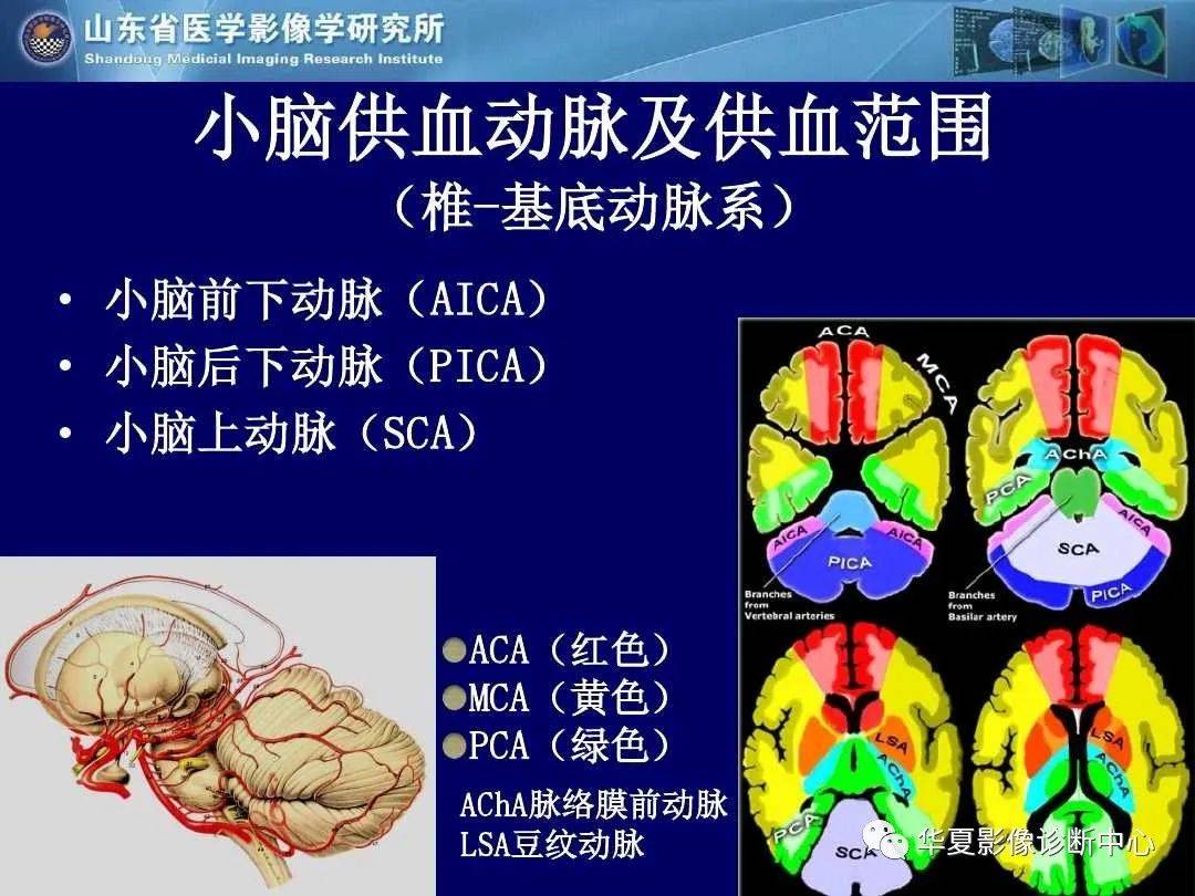 诊断|缺血性脑血管病的影像诊断