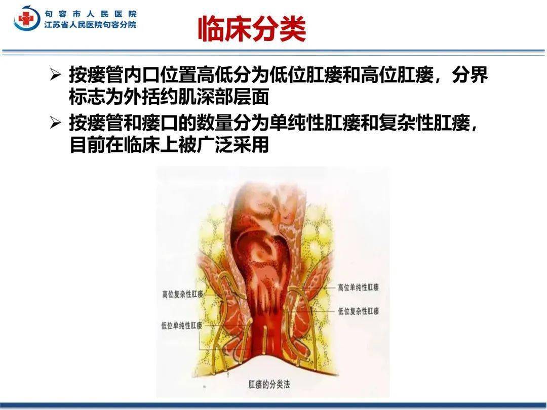 歪門邪道:肛瘻影像評估_解剖圖