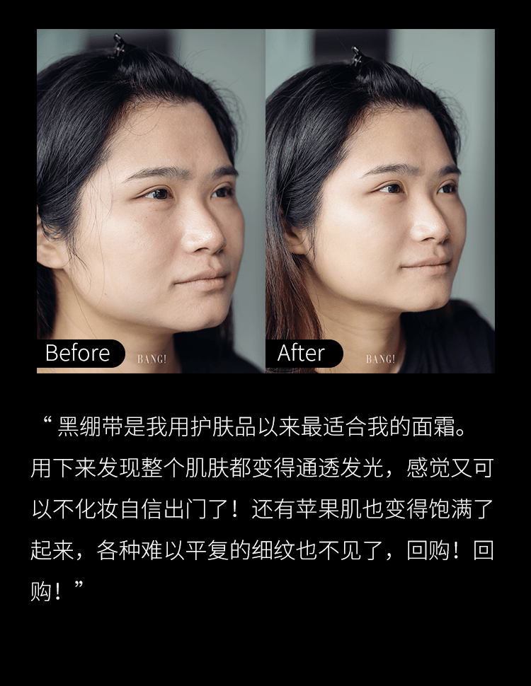 绷带黑绷带YYDS