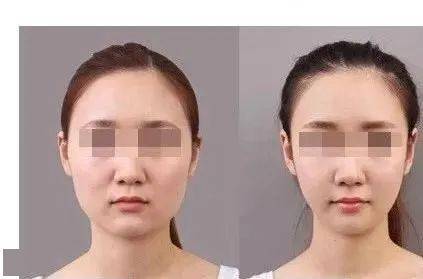 经络60岁的年龄，20岁的脸：女人想越活越年轻，一定要懂得这个秘诀