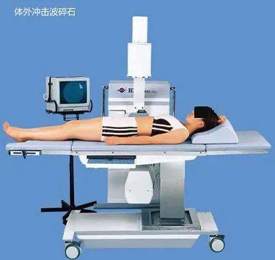体外冲击波碎石的优势与不足