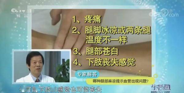 部位|血管堵了会“要命”！快对照自查，出现这几个症状就要小心了