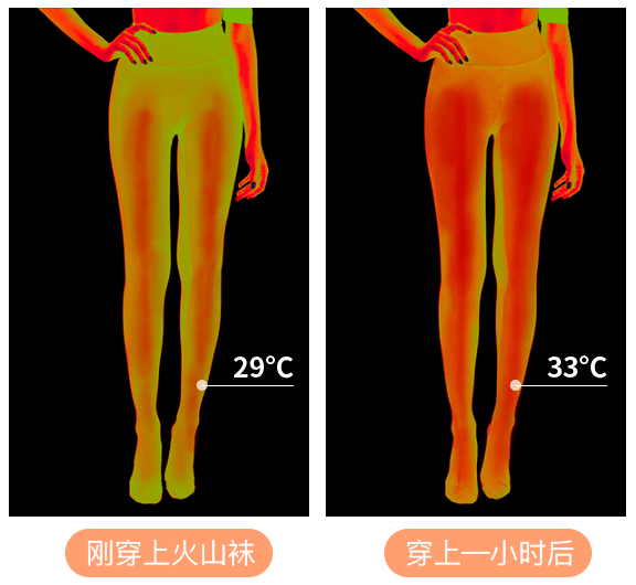 优惠 吴昕这次开挂了？从大象腿到女团腿她究竟做了啥？