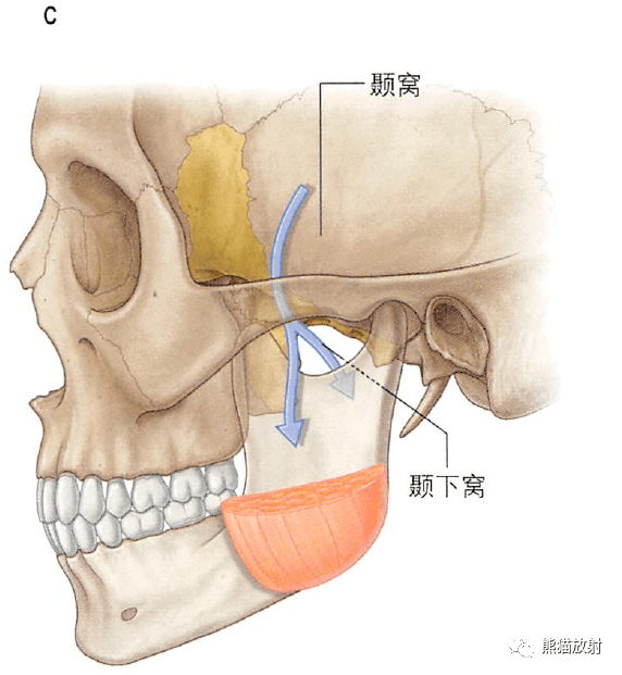 解剖丨颞下窝翼腭窝颞下颌关节