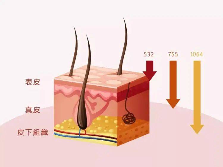 治疗松江医生为你揭秘超皮秒的神奇之处→