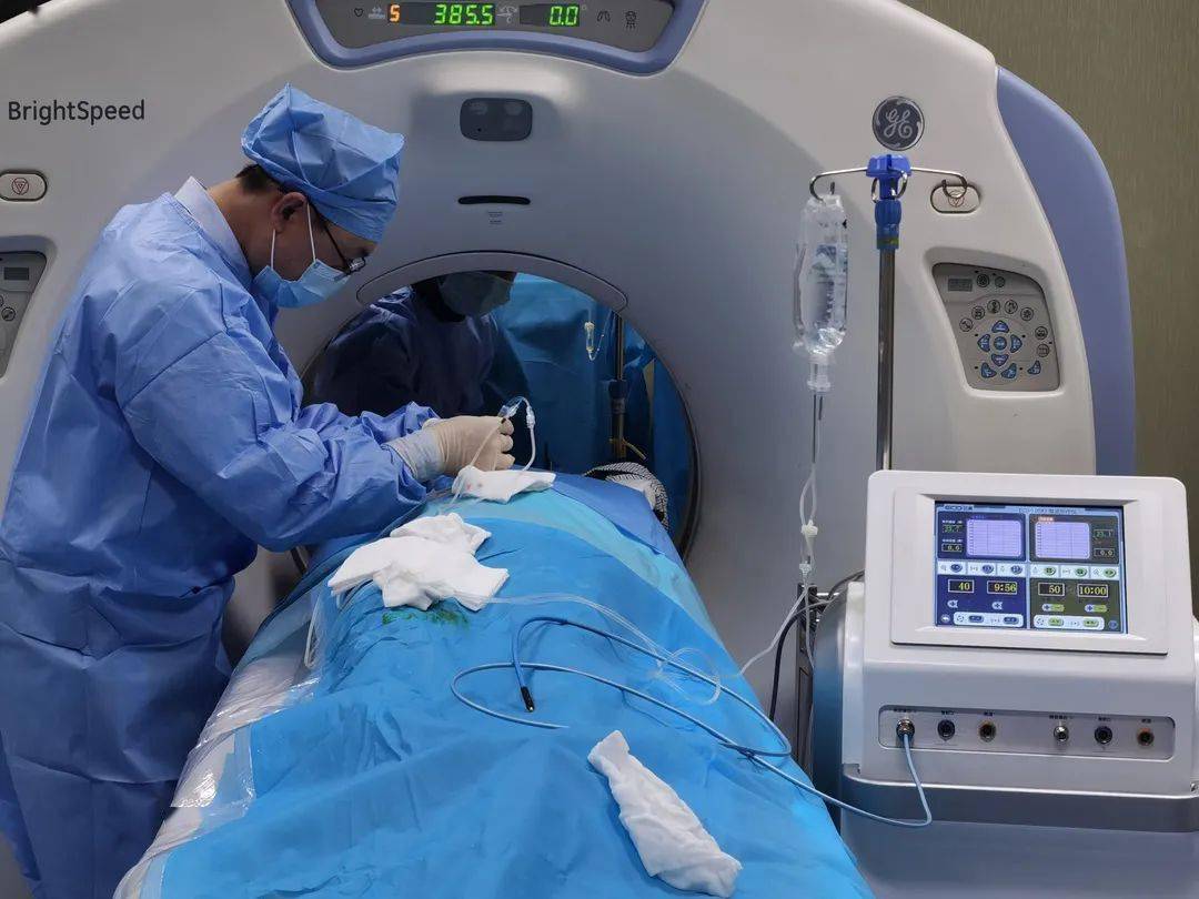 患者在接受微波消融术科室在针对肺癌的发病转移机理,化疗及分子靶向